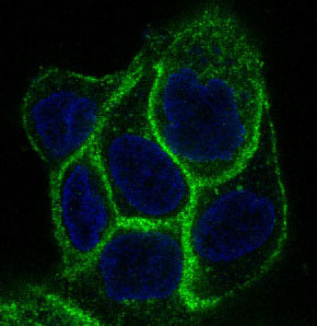 3 - Anti-EGFR Rabbit Monoclonal Antibody ABO15141