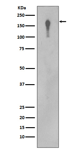 1 - Anti-EGFR Rabbit Monoclonal Antibody ABO15141