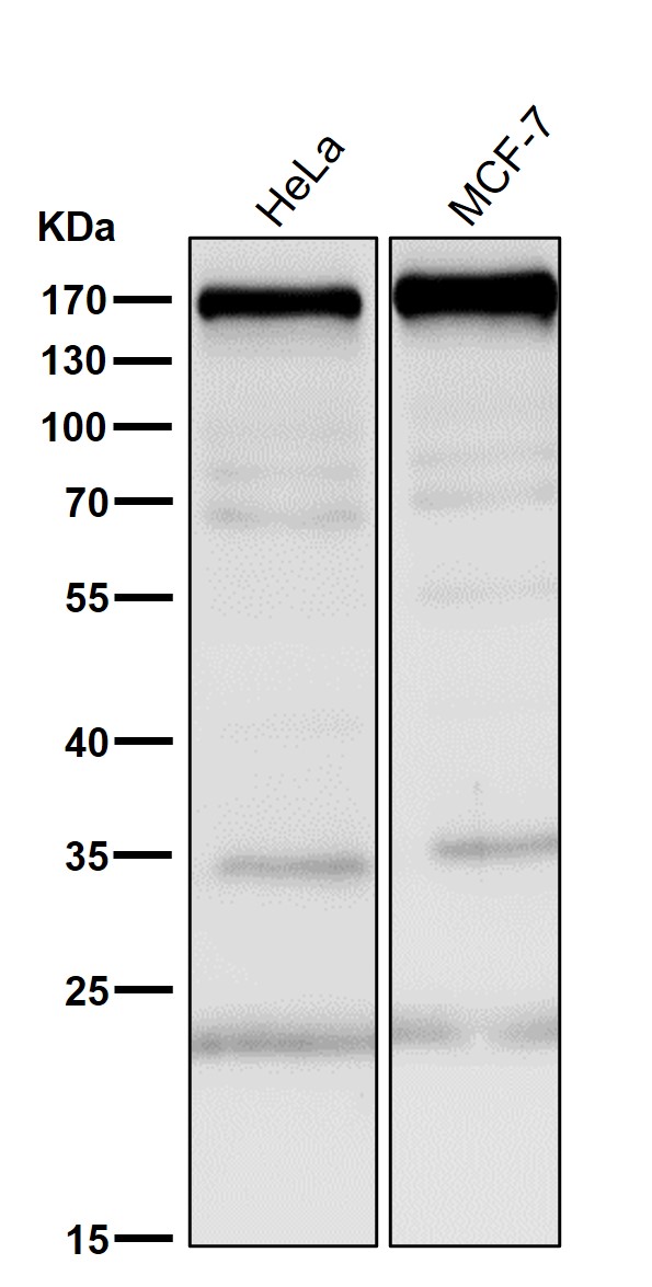 1 - Anti-EGFR Rabbit Monoclonal Antibody ABO15141