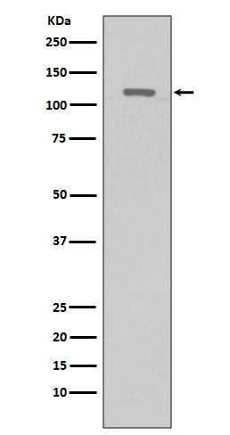1 - Anti-TERT Rabbit Monoclonal Antibody ABO15142