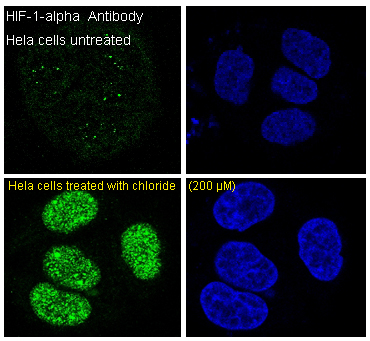 3 - Anti-HIF-1 alpha Rabbit Monoclonal Antibody ABO15143