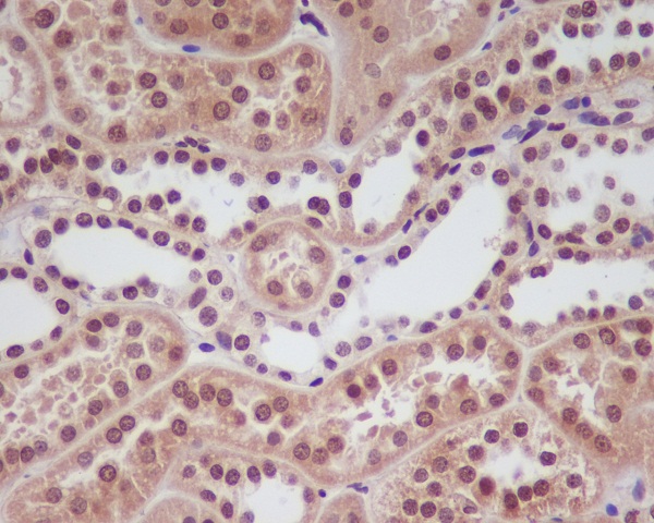 2 - Anti-HIF-1 alpha Rabbit Monoclonal Antibody ABO15143