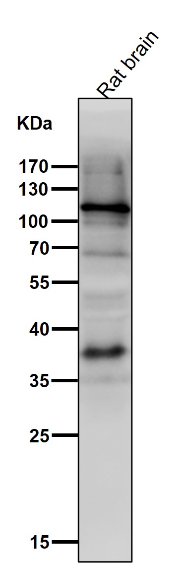 1 - Anti-HIF-1 alpha Rabbit Monoclonal Antibody ABO15143