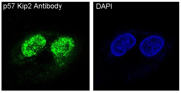 3 - Anti-p57 Kip2 Rabbit Monoclonal Antibody ABO15144