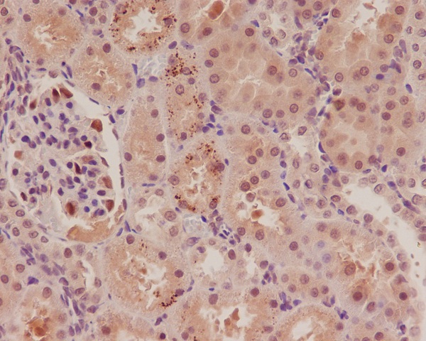 2 - Anti-p57 Kip2 Rabbit Monoclonal Antibody ABO15144