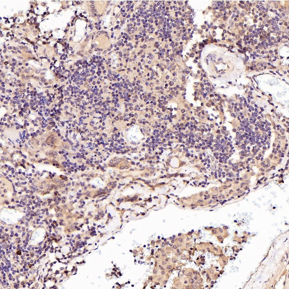2 - Anti-p57 Kip2 Rabbit Monoclonal Antibody ABO15144