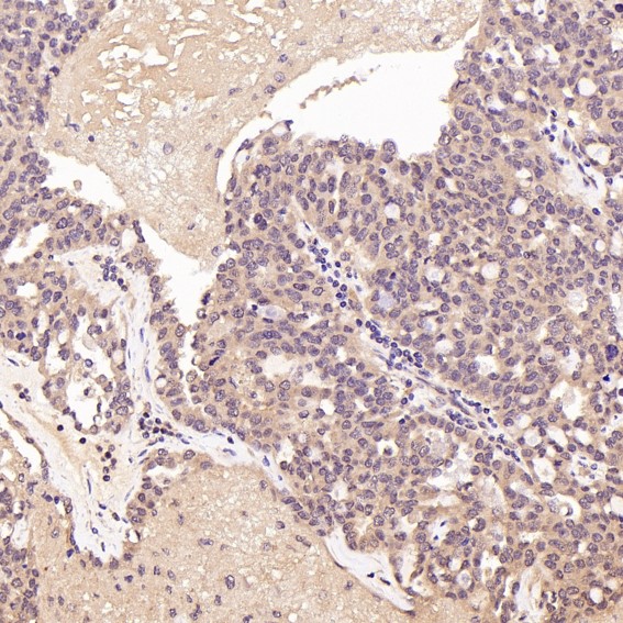 2 - Anti-p57 Kip2 Rabbit Monoclonal Antibody ABO15144