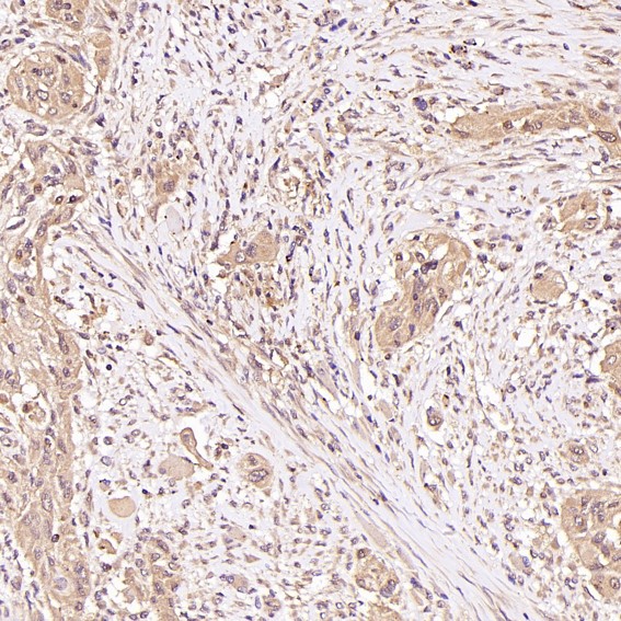 2 - Anti-p57 Kip2 Rabbit Monoclonal Antibody ABO15144