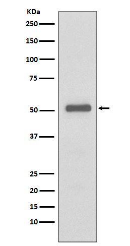 1 - Anti-p57 Kip2 Rabbit Monoclonal Antibody ABO15144