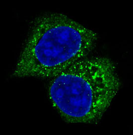 3 - Anti-Akt(pan) 1/2/3 Rabbit Monoclonal Antibody ABO15145