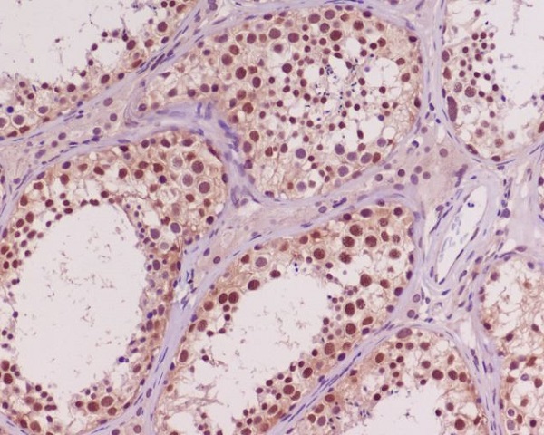 2 - Anti-Akt(pan) 1/2/3 Rabbit Monoclonal Antibody ABO15145