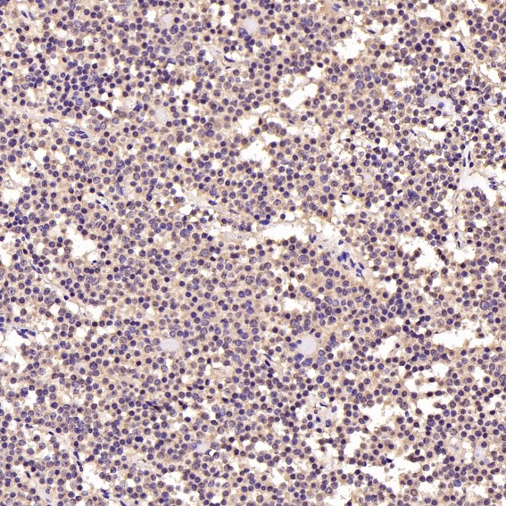 2 - Anti-Akt(pan) 1/2/3 Rabbit Monoclonal Antibody ABO15145