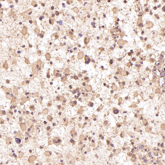 2 - Anti-Akt(pan) 1/2/3 Rabbit Monoclonal Antibody ABO15145