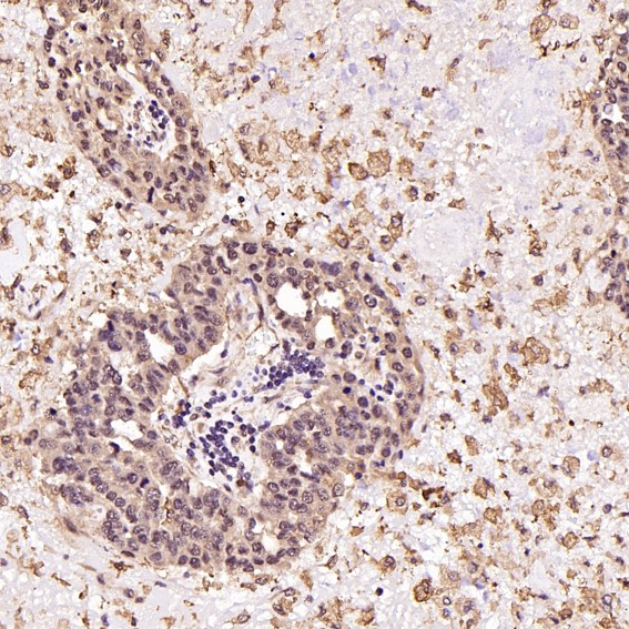 2 - Anti-Akt(pan) 1/2/3 Rabbit Monoclonal Antibody ABO15145