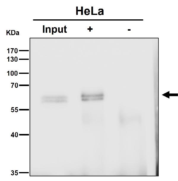 1 - Anti-Akt(pan) 1/2/3 Rabbit Monoclonal Antibody ABO15145