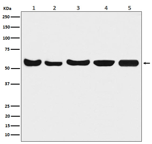 1 - Anti-Akt(pan) 1/2/3 Rabbit Monoclonal Antibody ABO15145