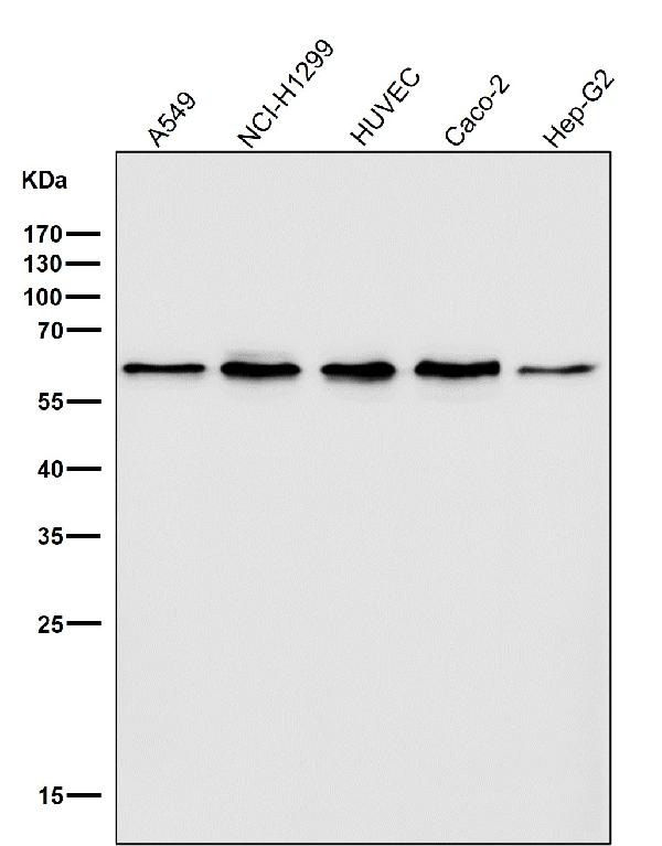 1 - Anti-Akt(pan) 1/2/3 Rabbit Monoclonal Antibody ABO15145