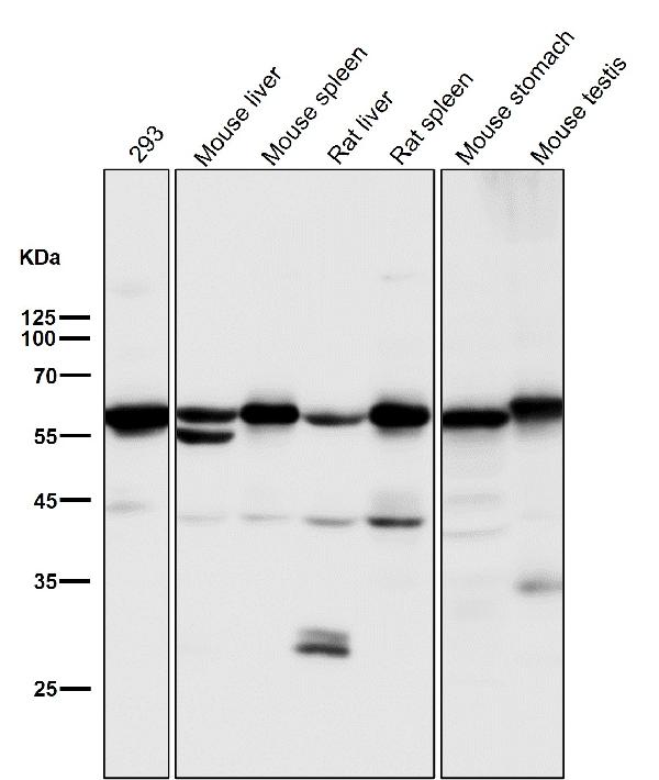 1 - Anti-Akt(pan) 1/2/3 Rabbit Monoclonal Antibody ABO15145