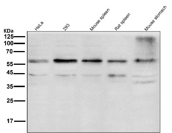 1 - Anti-Akt(pan) 1/2/3 Rabbit Monoclonal Antibody ABO15145