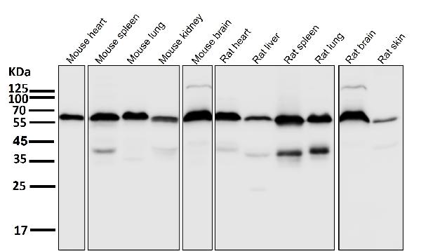 1 - Anti-Akt(pan) 1/2/3 Rabbit Monoclonal Antibody ABO15145