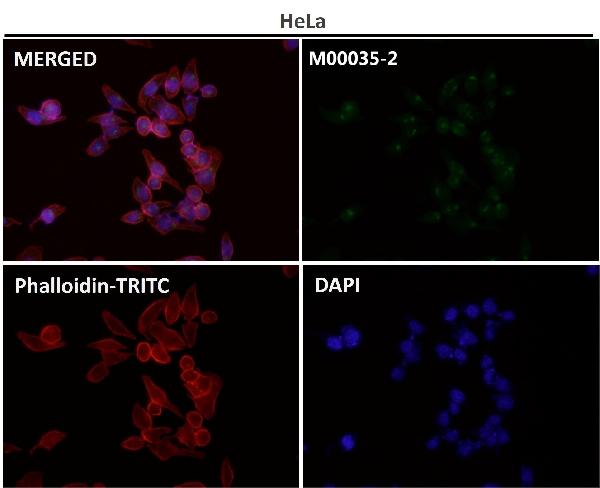 1 - Anti-BDNF Rabbit Monoclonal Antibody ABO15146