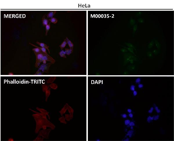 1 - Anti-BDNF Rabbit Monoclonal Antibody ABO15146