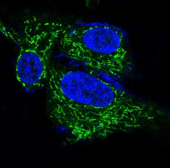 3 - Anti-BDNF Rabbit Monoclonal Antibody ABO15146