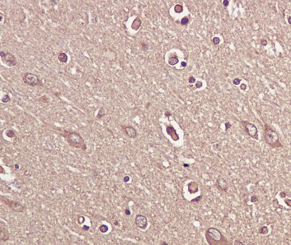 2 - Anti-BDNF Rabbit Monoclonal Antibody ABO15146