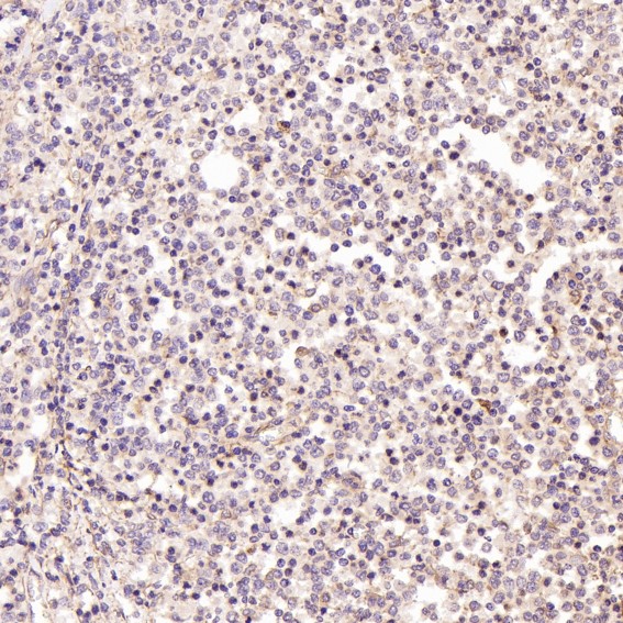 2 - Anti-BDNF Rabbit Monoclonal Antibody ABO15146