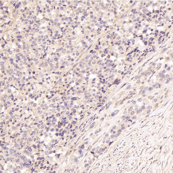 2 - Anti-BDNF Rabbit Monoclonal Antibody ABO15146