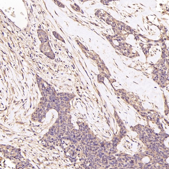 2 - Anti-BDNF Rabbit Monoclonal Antibody ABO15146