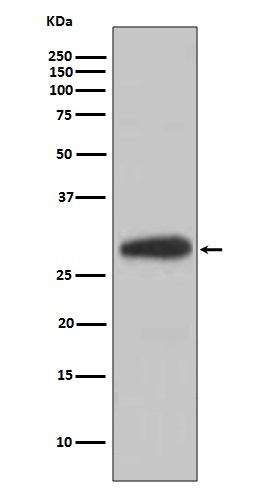 1 - Anti-BDNF Rabbit Monoclonal Antibody ABO15146