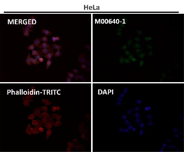 1 - Anti-JAG1 Rabbit Monoclonal Antibody ABO15147
