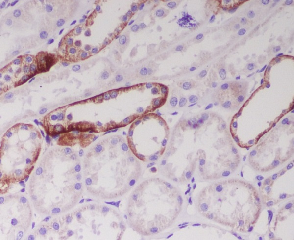 2 - Anti-JAG1 Rabbit Monoclonal Antibody ABO15147