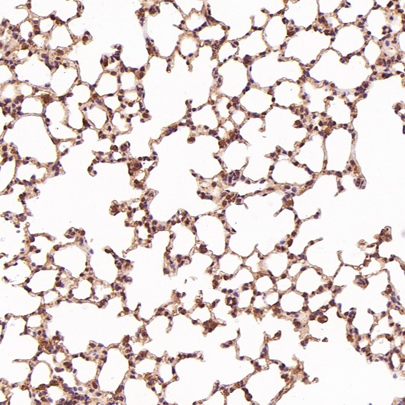 2 - Anti-JAG1 Rabbit Monoclonal Antibody ABO15147