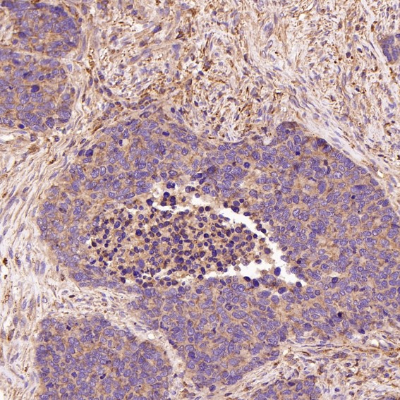 2 - Anti-JAG1 Rabbit Monoclonal Antibody ABO15147