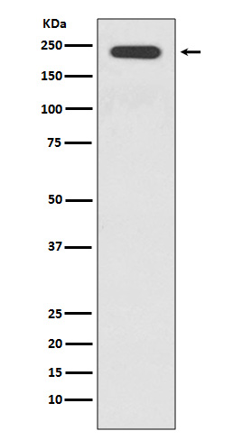 1 - Anti-JAG1 Rabbit Monoclonal Antibody ABO15147