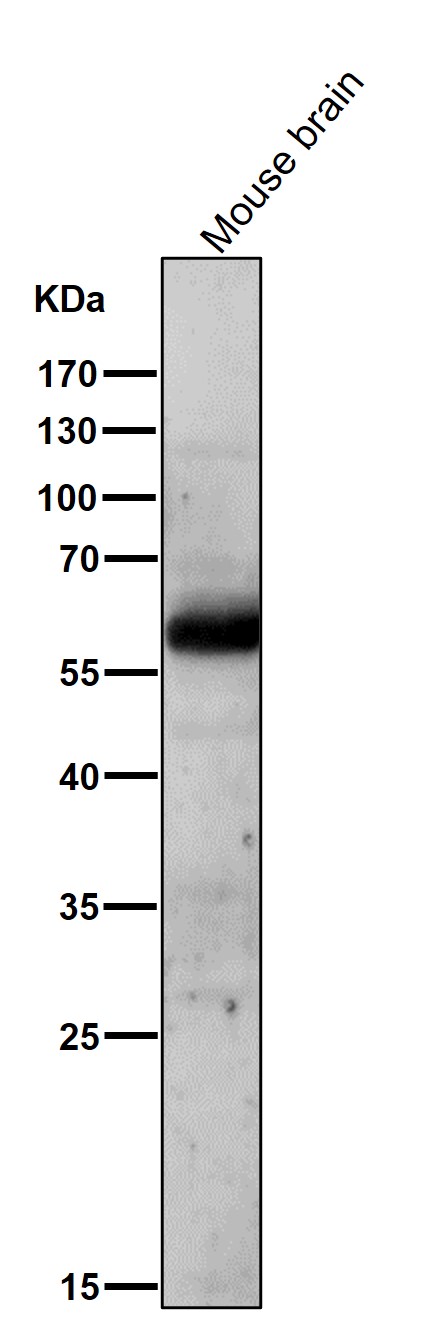 1 - Anti-AKT1/2 Rabbit Monoclonal Antibody ABO15150
