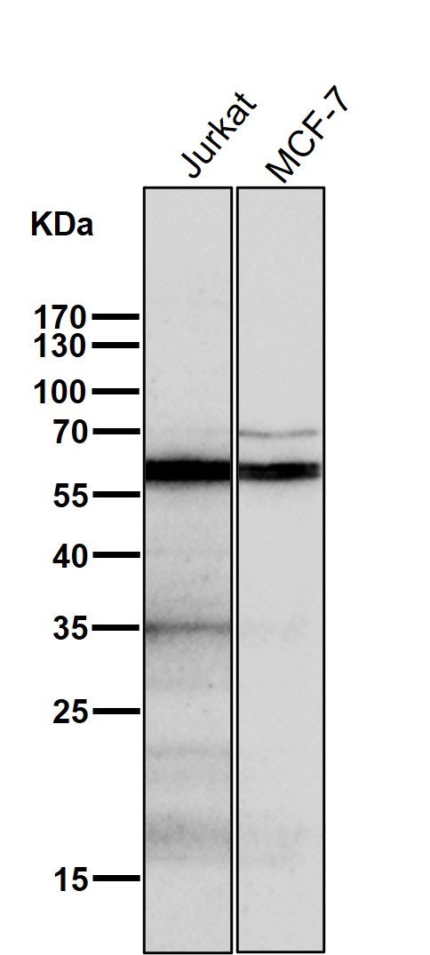 1 - Anti-AKT1/2 Rabbit Monoclonal Antibody ABO15150