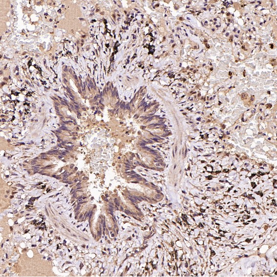 2 - Anti-FOXP3 Rabbit Monoclonal Antibody ABO15151