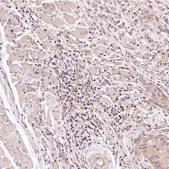 2 - Anti-FOXP3 Rabbit Monoclonal Antibody ABO15151