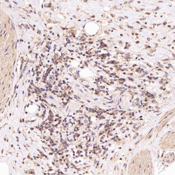 2 - Anti-FOXP3 Rabbit Monoclonal Antibody ABO15151