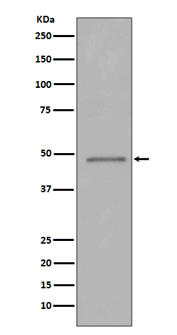 1 - Anti-FOXP3 Rabbit Monoclonal Antibody ABO15151