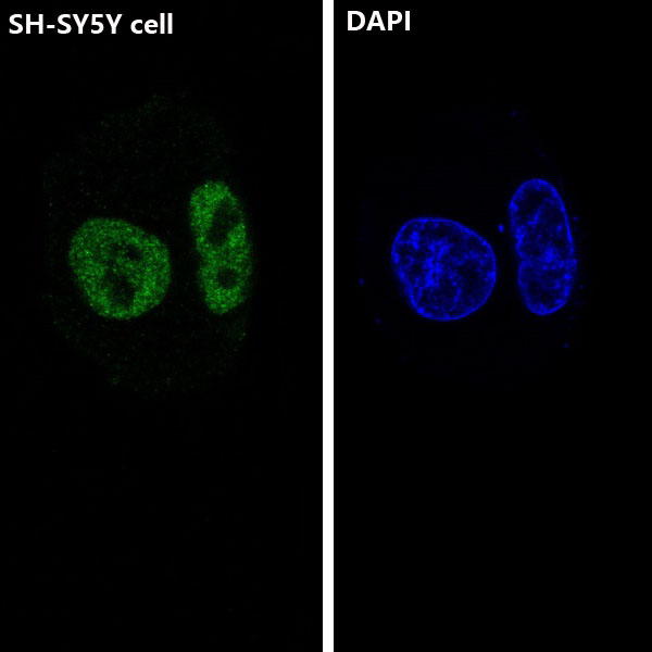 3 - Anti-ARID1A Rabbit Monoclonal Antibody ABO15152