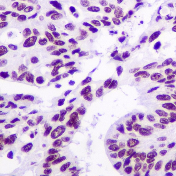2 - Anti-ARID1A Rabbit Monoclonal Antibody ABO15152