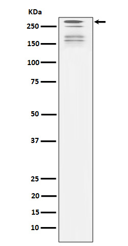 1 - Anti-ARID1A Rabbit Monoclonal Antibody ABO15152
