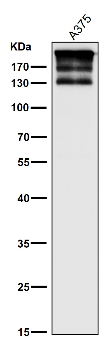 1 - Anti-ARID1A Rabbit Monoclonal Antibody ABO15152