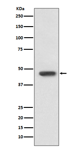 1 - Anti-FOXP3 Rabbit Monoclonal Antibody ABO15153