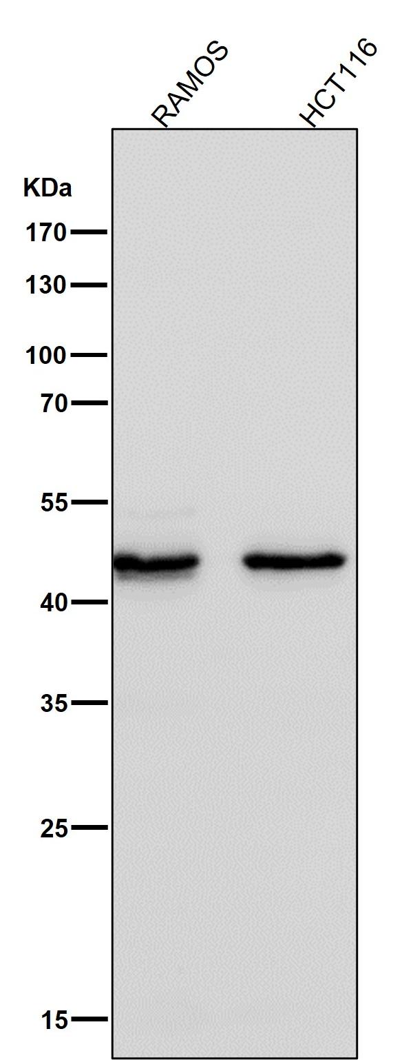 1 - Anti-FOXP3 Rabbit Monoclonal Antibody ABO15153