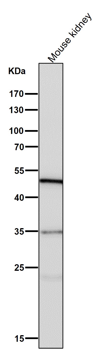 1 - Anti-FOXP3 Rabbit Monoclonal Antibody ABO15153